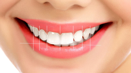 Gülüş Tasarımı Ve Protez Uygulamaları Nedir?