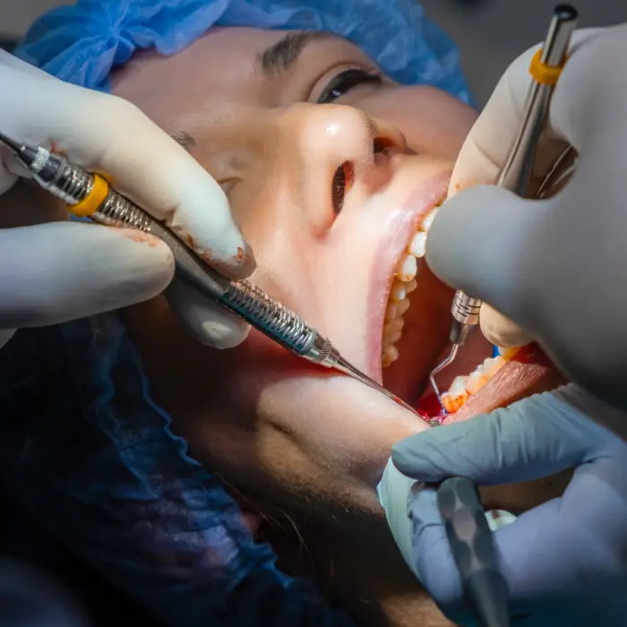 Greft Membran Nedir? Blog Greft Membran Nedir? Blog