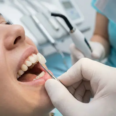 Lamine Diş Kaplama Blog Lamine Diş Kaplama Blog