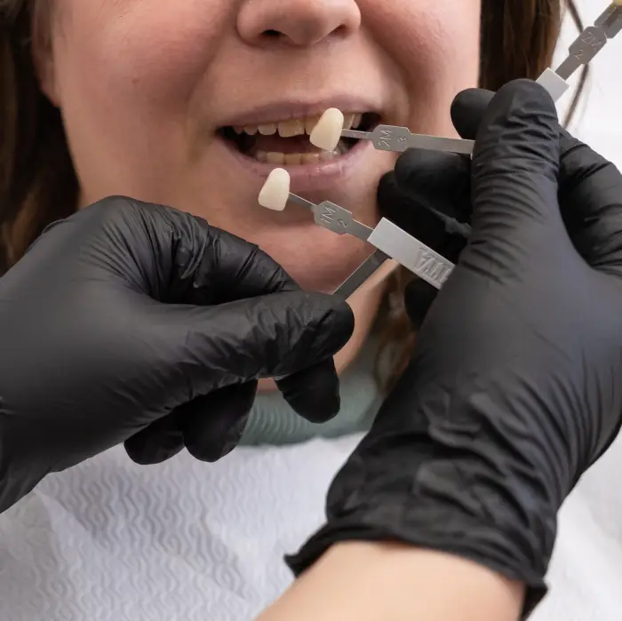 Kuron Tedavisi Nedir? Blog Kuron Tedavisi Nedir? Blog